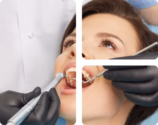 Bad Breath Treatment benefits at Shrouf Dental House