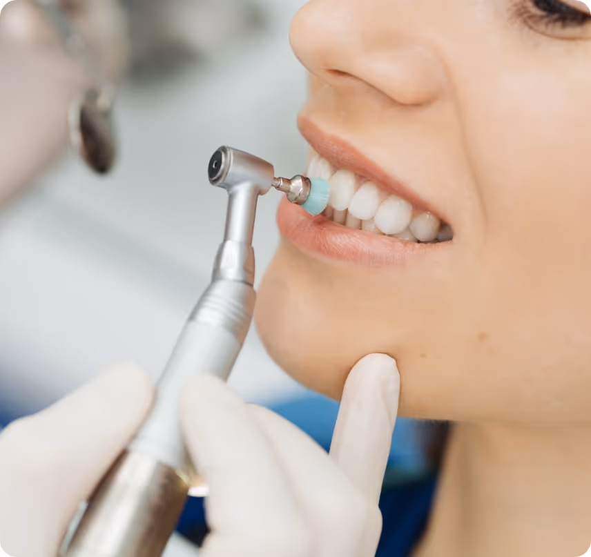 When do you need Bad Breath Treatment at Shrouf Dental House