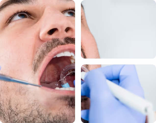 Healthy mouth cleaning benefits at Shrouf Dental House