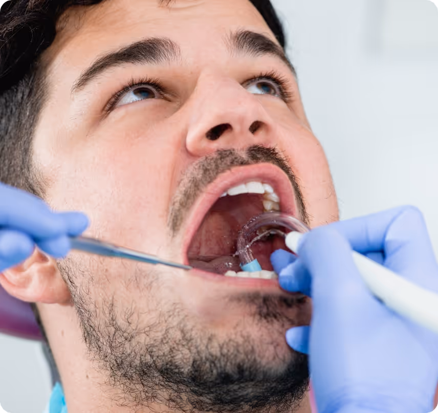 Healthy mouth cleaning benefits at Shrouf Dental House