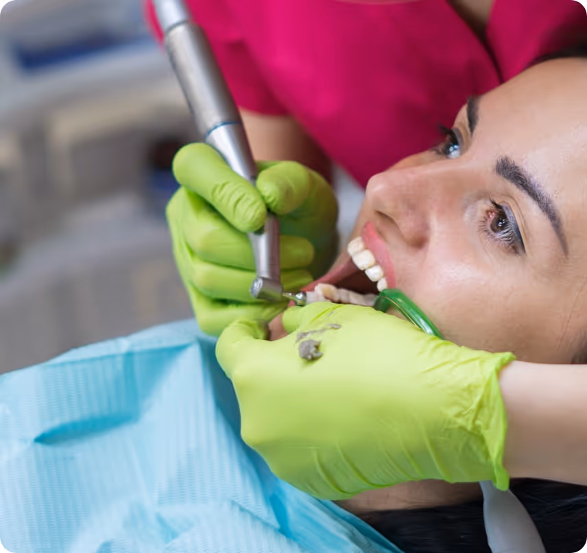 When do you need Healthy mouth cleaning at Shrouf Dental House