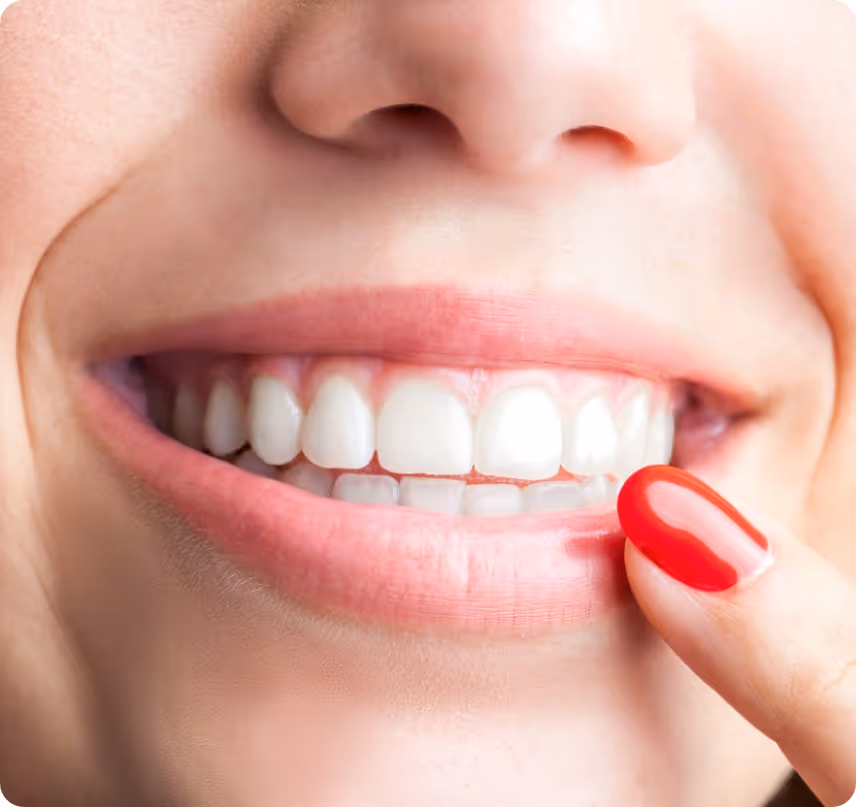 Take Home Whitening benefits at Shrouf Dental House