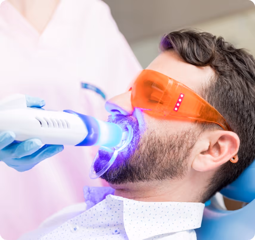 In-office Whitening benefits at Shrouf Dental House