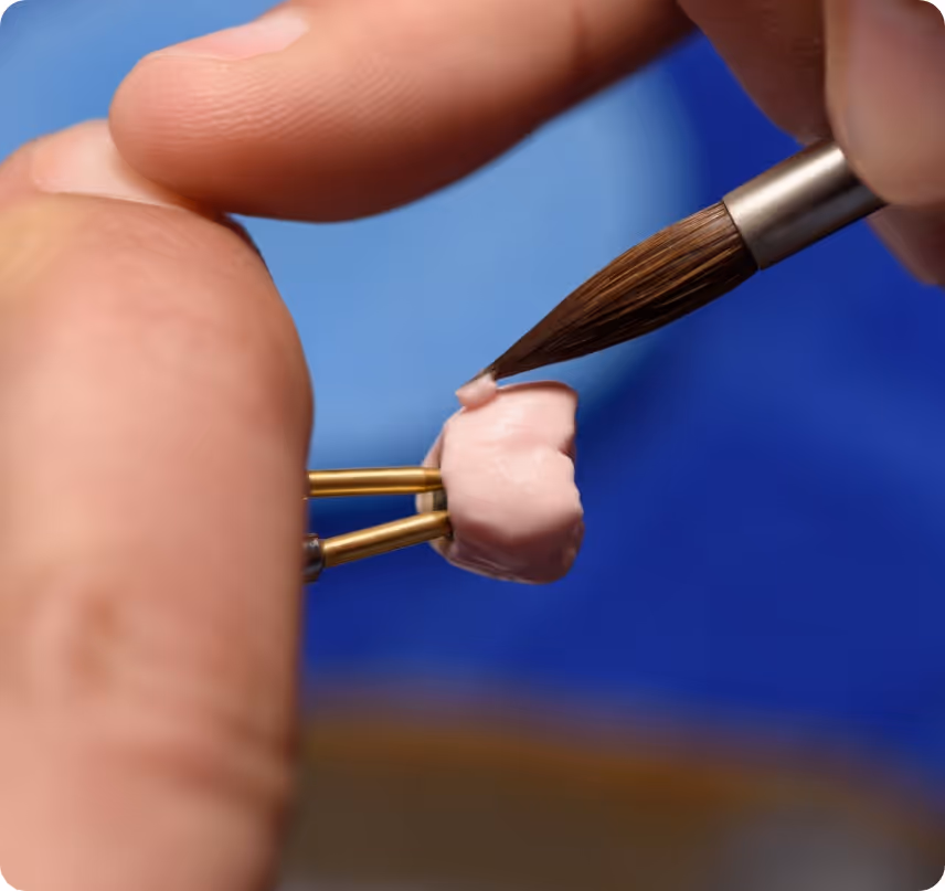 When do you need Cosmetic Crowns at Shrouf Dental House