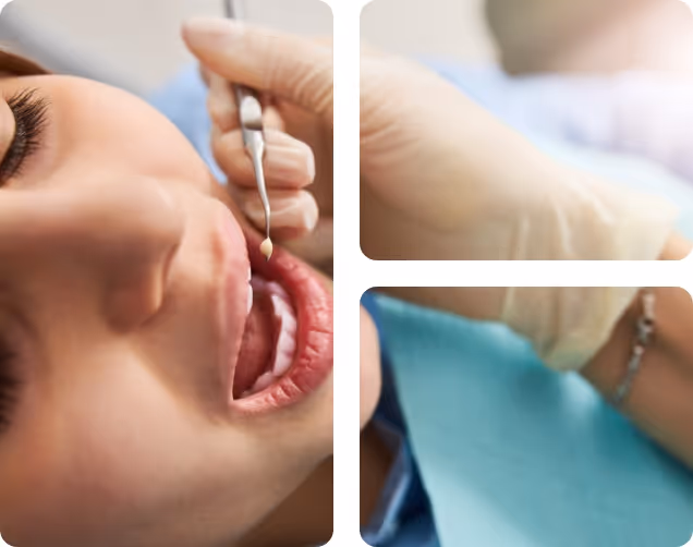 Cosmetic Restorations benefits at Shrouf Dental House