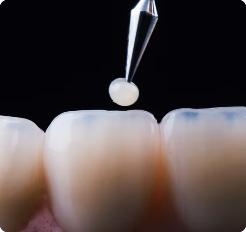 When do you need Cosmetic Restorations at Shrouf Dental House