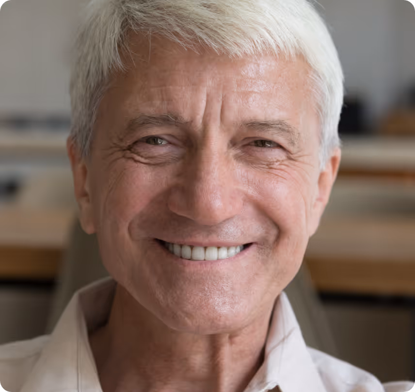 Fixed Full Mouth Implants benefits at Shrouf Dental House