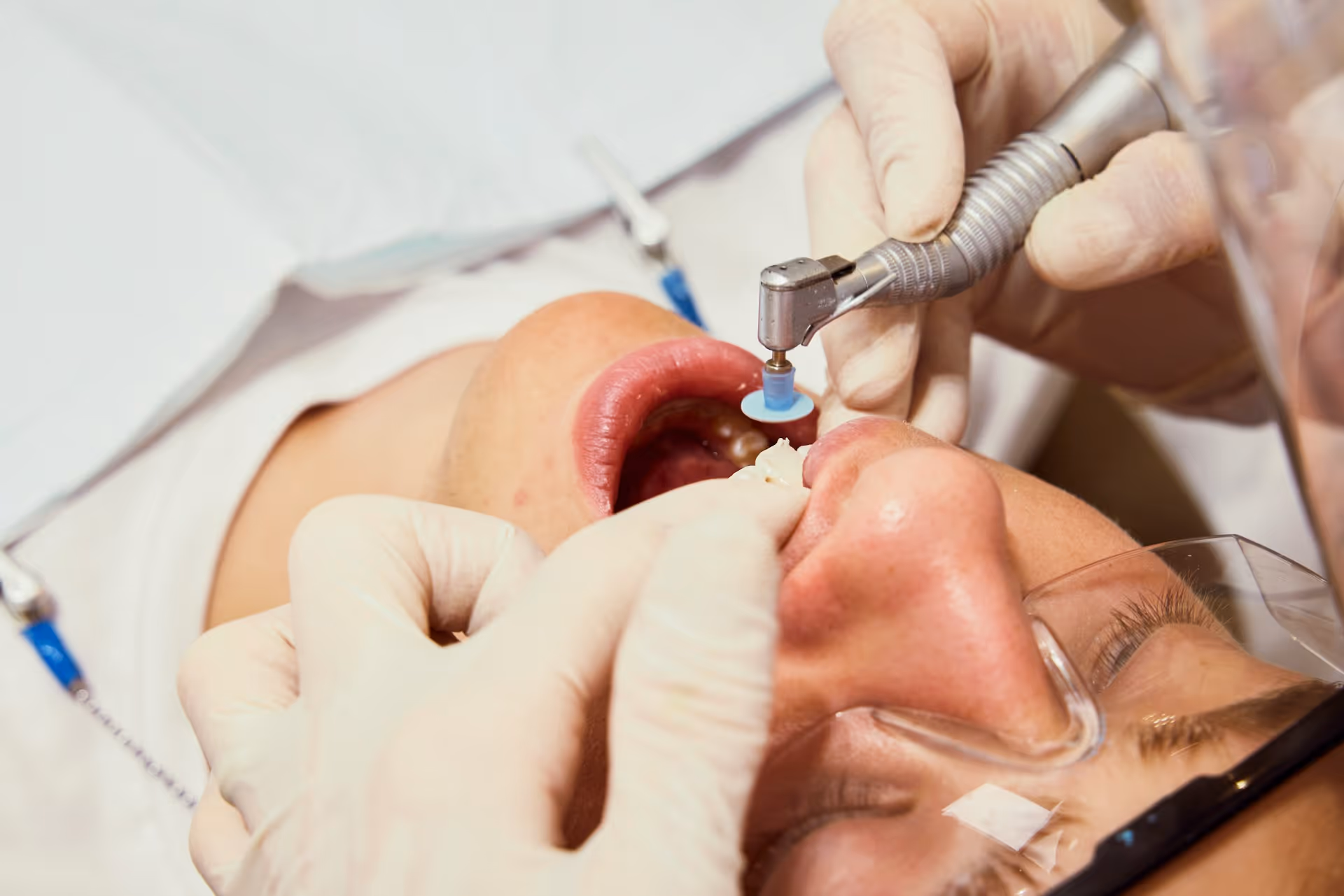 Understanding Different Types of Oral Surgery Procedures