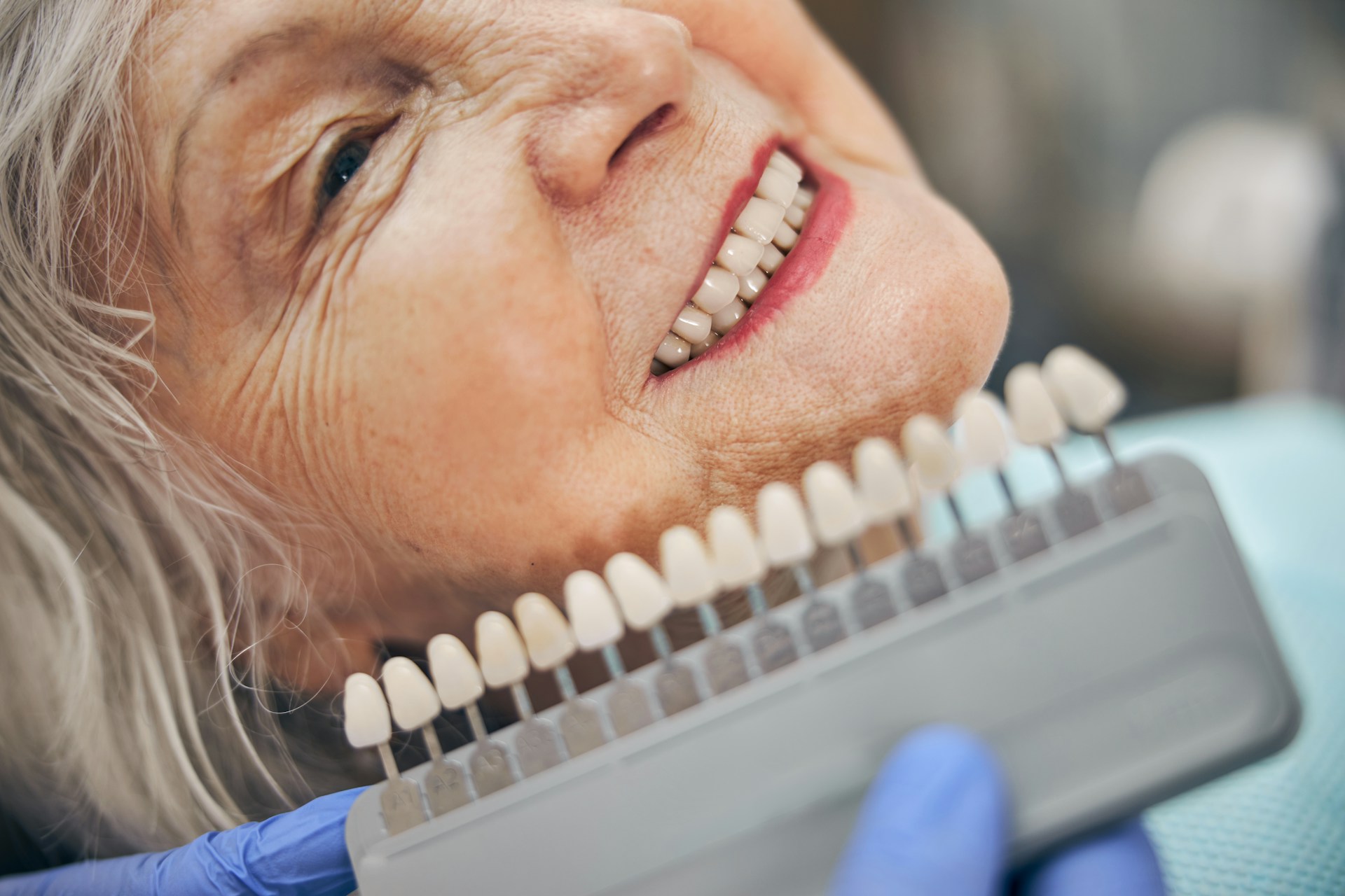 How Fixed Full Mouth Implants Can Give Seniors a Full Smile