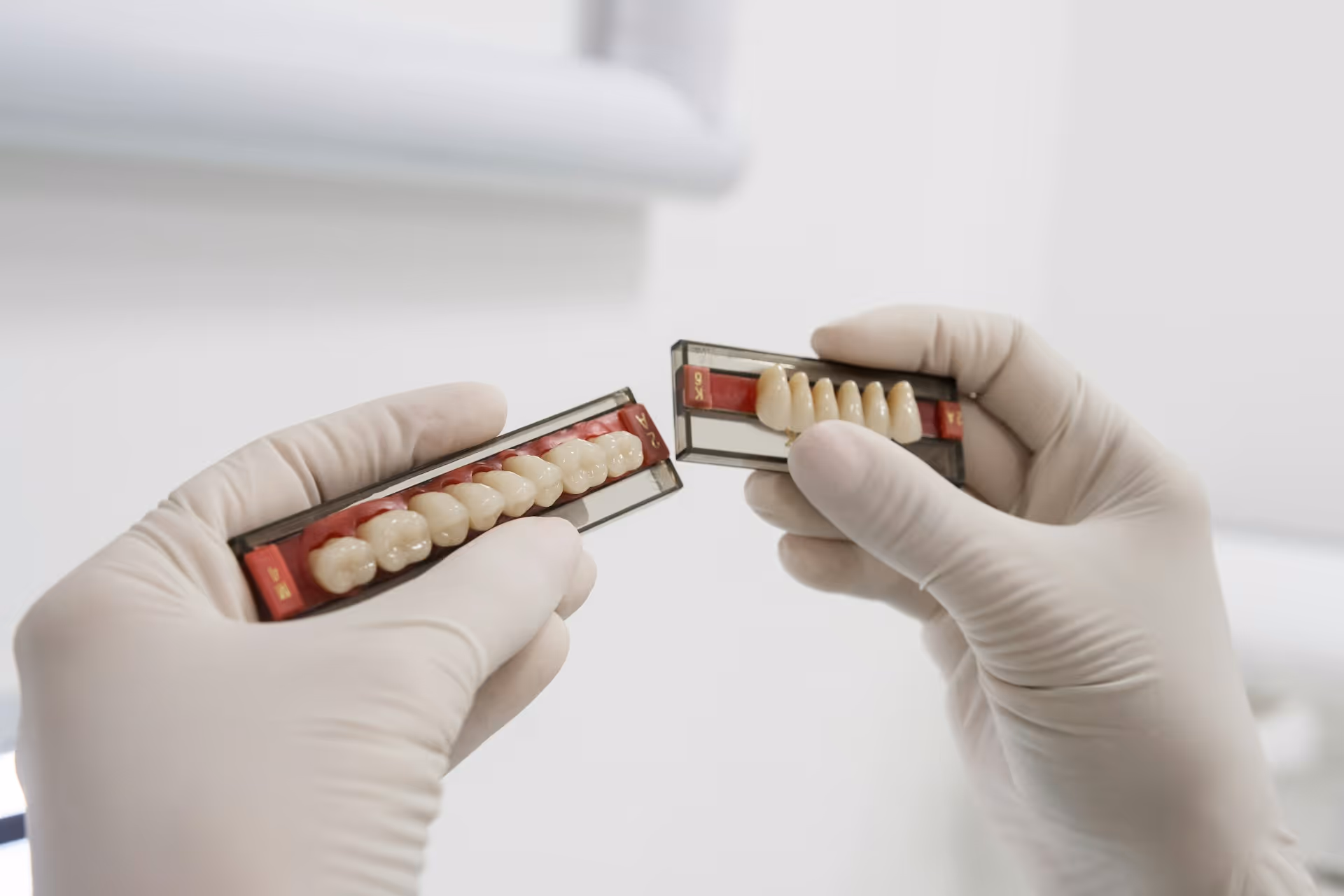 Why Implant-Supported Dentures Feel More Secure Than Adhesives