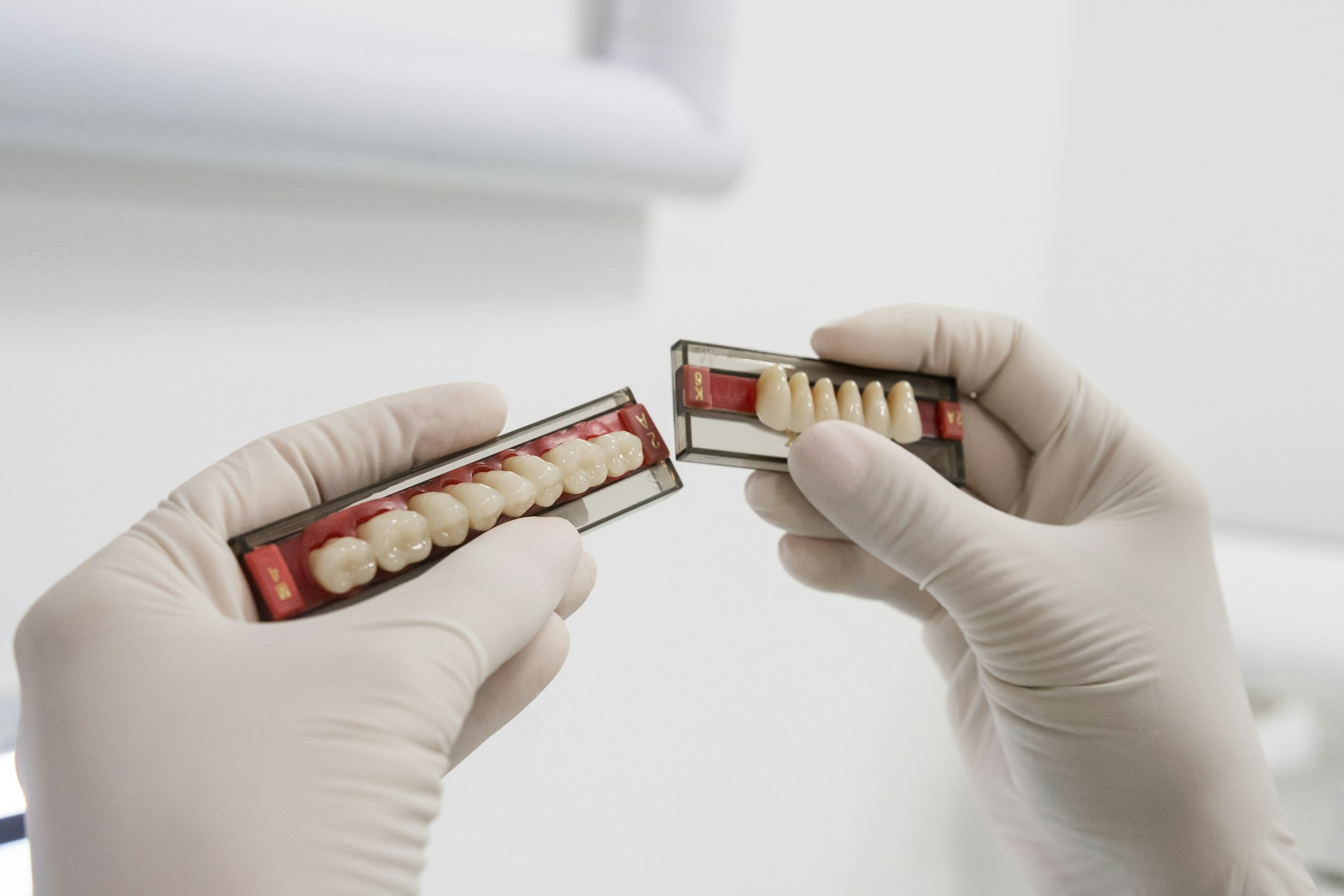Why Implant-Supported Dentures Feel More Secure Than Adhesives