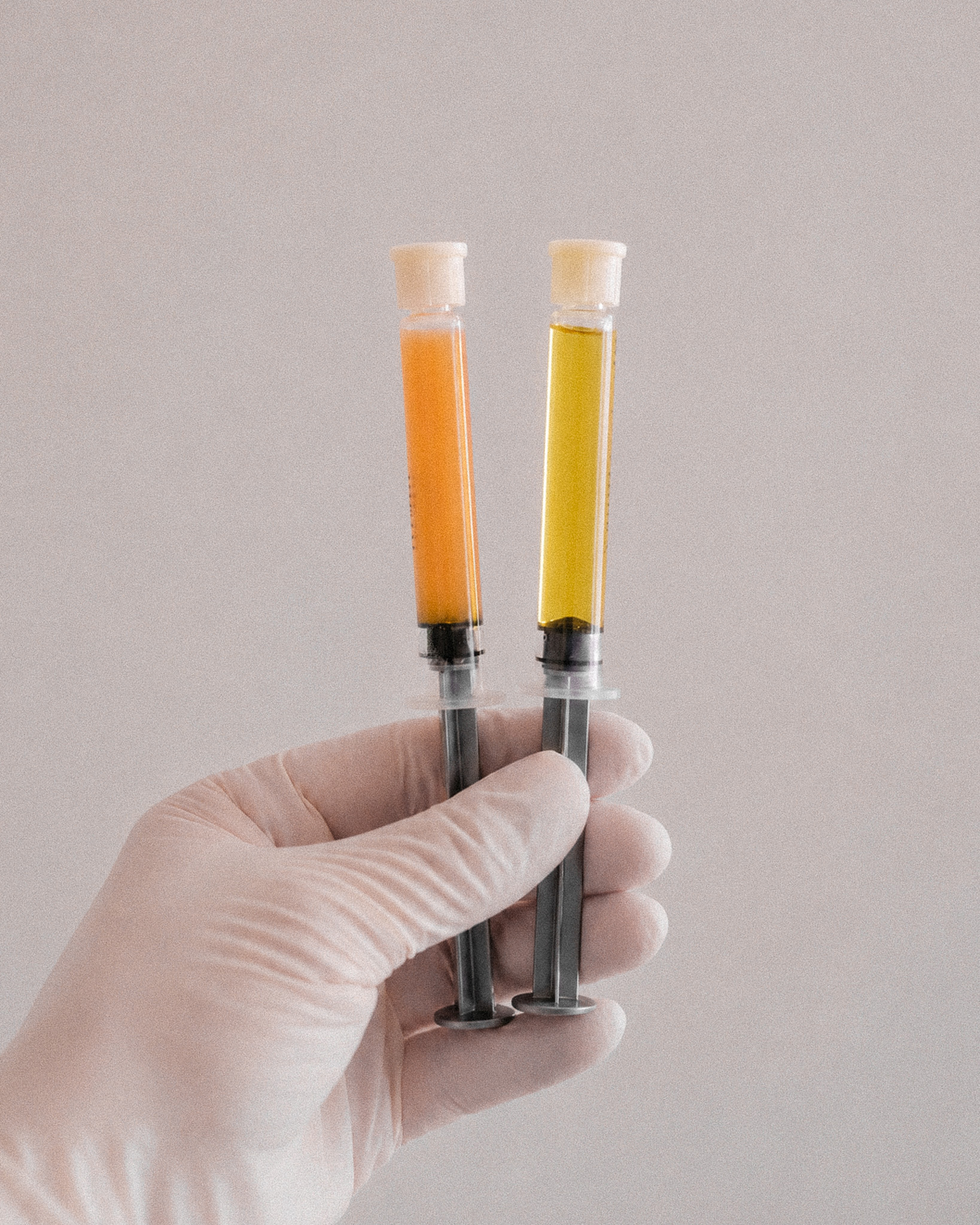 Two syringes held in a gloved hand: PRP on the left, platelet-poor plasma on the right