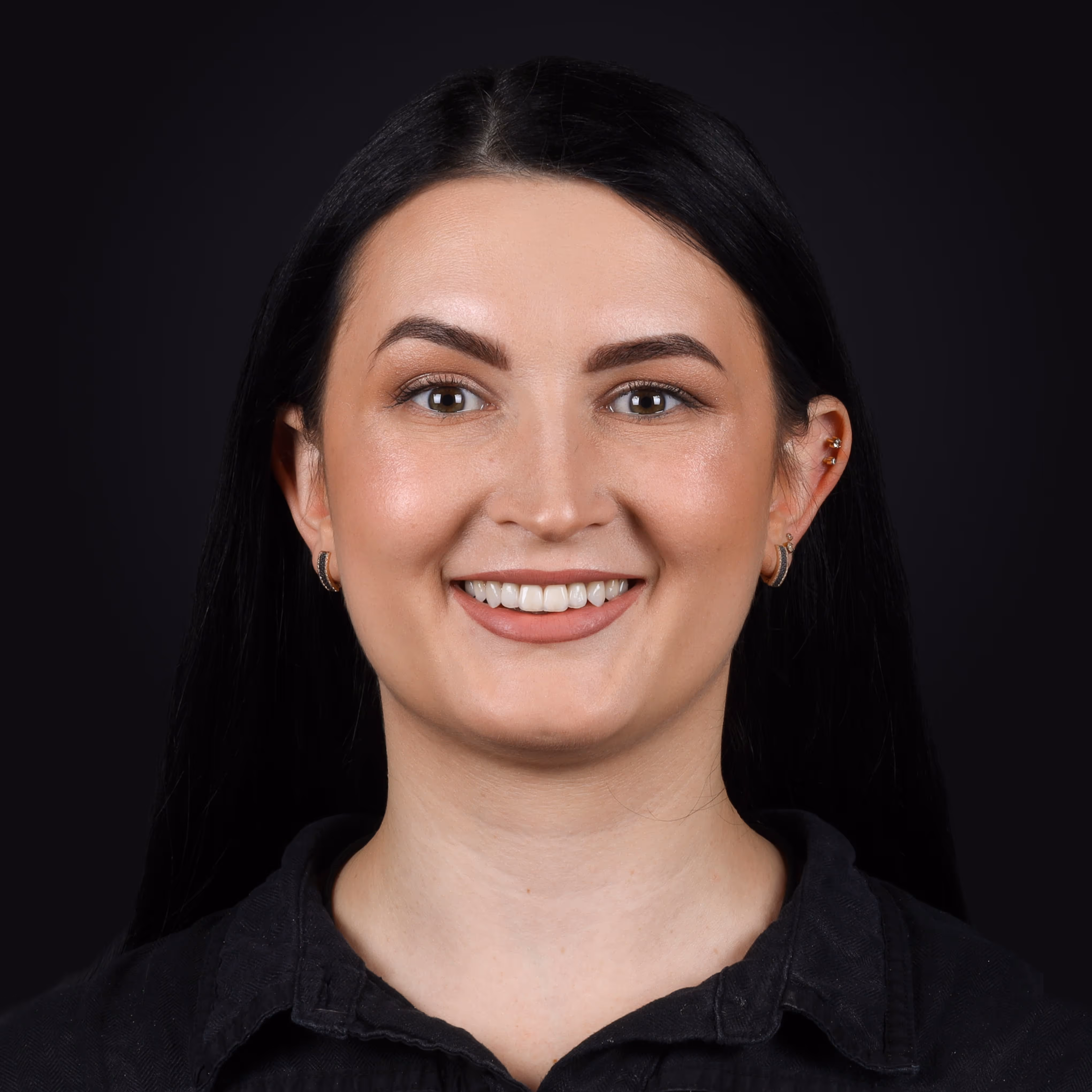 Анна — жінка з темним волоссям, пройшла ортодонтію, терапію та хірургію з керамічними реставраціями.