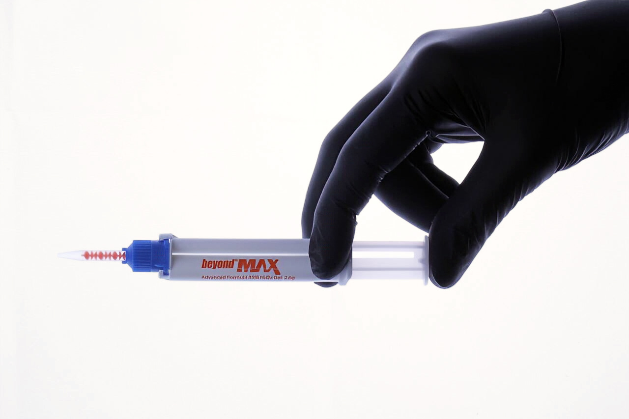 Процедура офісного відбілювання зубів для освітлення емалі у пацієнтки Анжеліки перед естетичним лікуванням у Sergatiy Dental Clinic