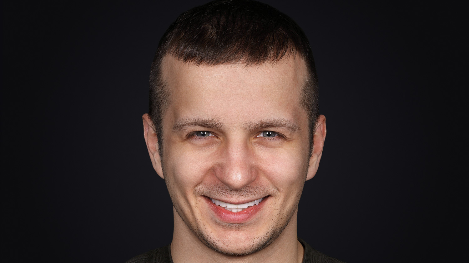 Фінальний результат лікування Олександра — ідеально рівна та природна усмішка після реставрації