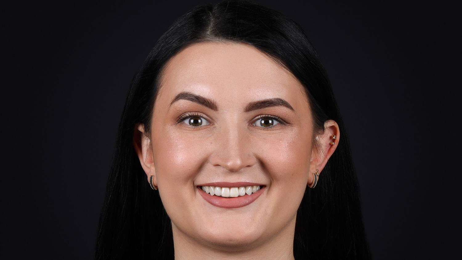 Анна після лікування — гармонійна усмішка з ідеальною лінією зубів, естетичний результат.