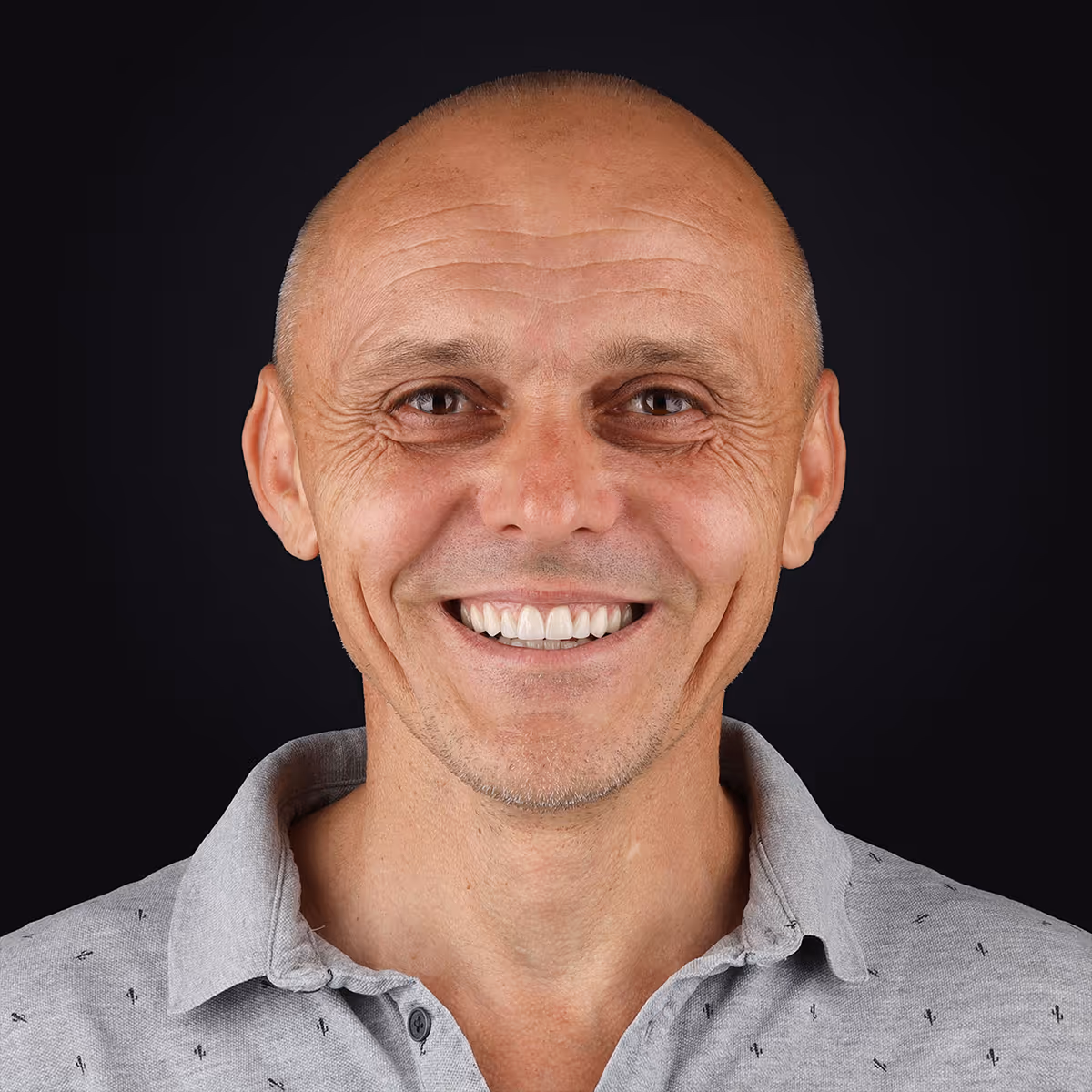 Пацієнт Сергій — кейс з ортодонтії, терапії та хірургії в Sergatiy Dental Clinic