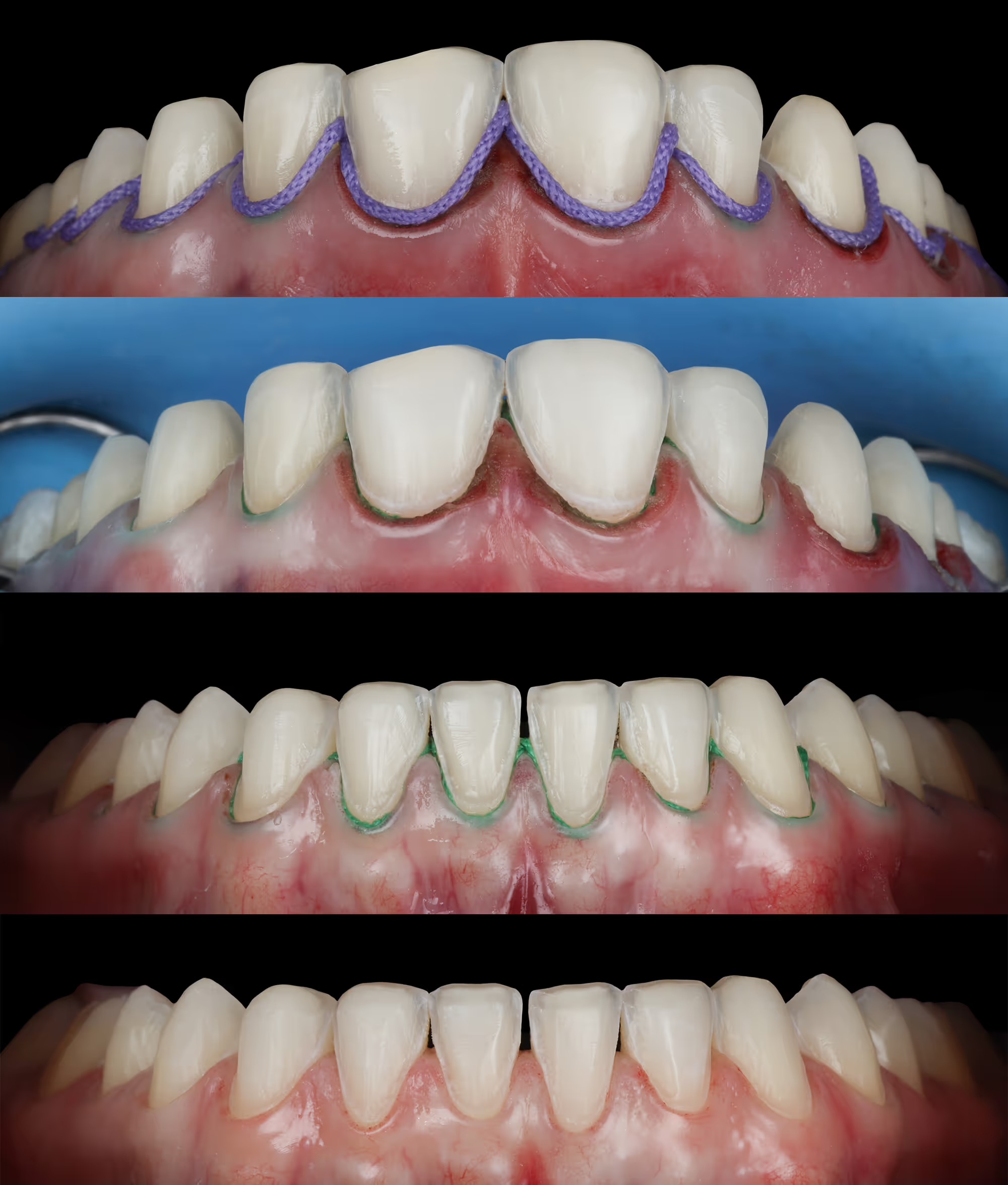 Initial situation right