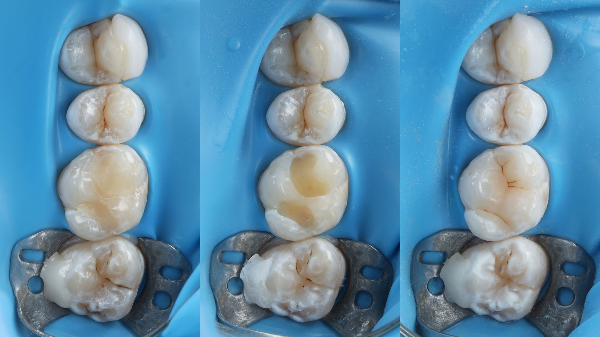 Initial situation right