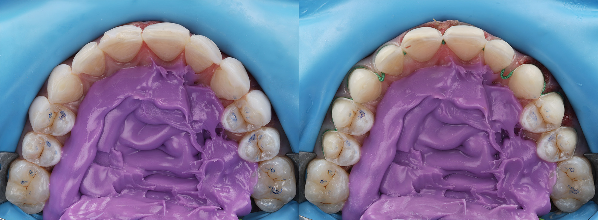 Initial situation right