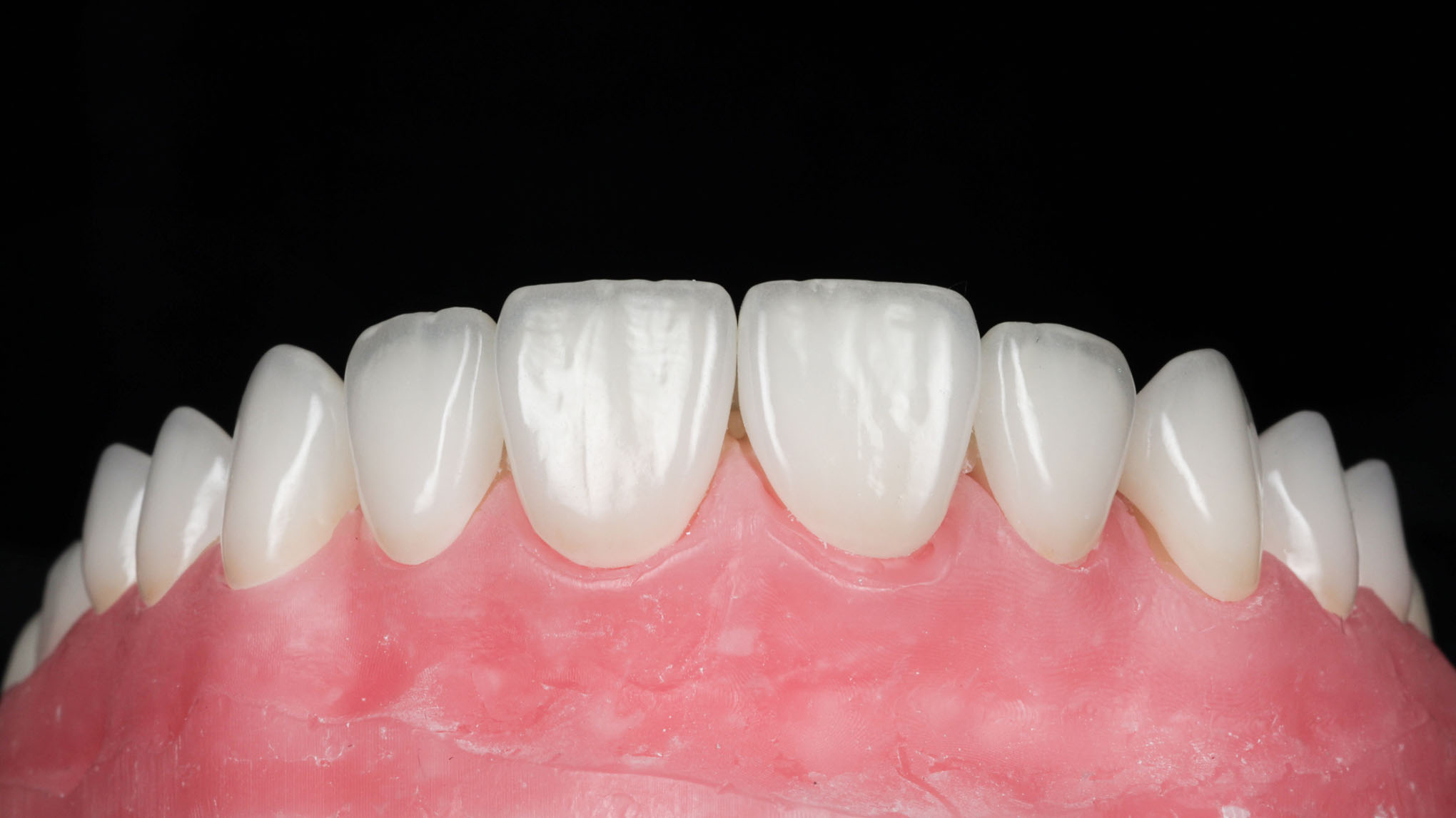 Initial situation right