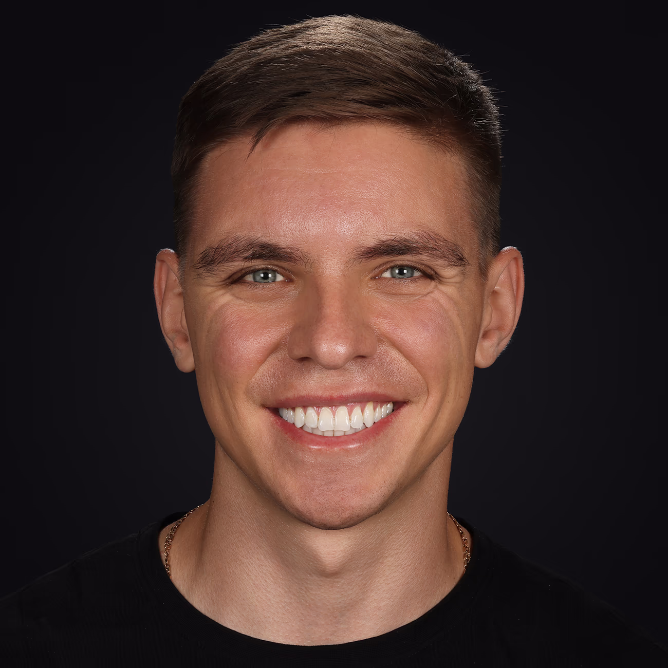 Пацієнт Віктор після ортодонтичного лікування з рівною усмішкою