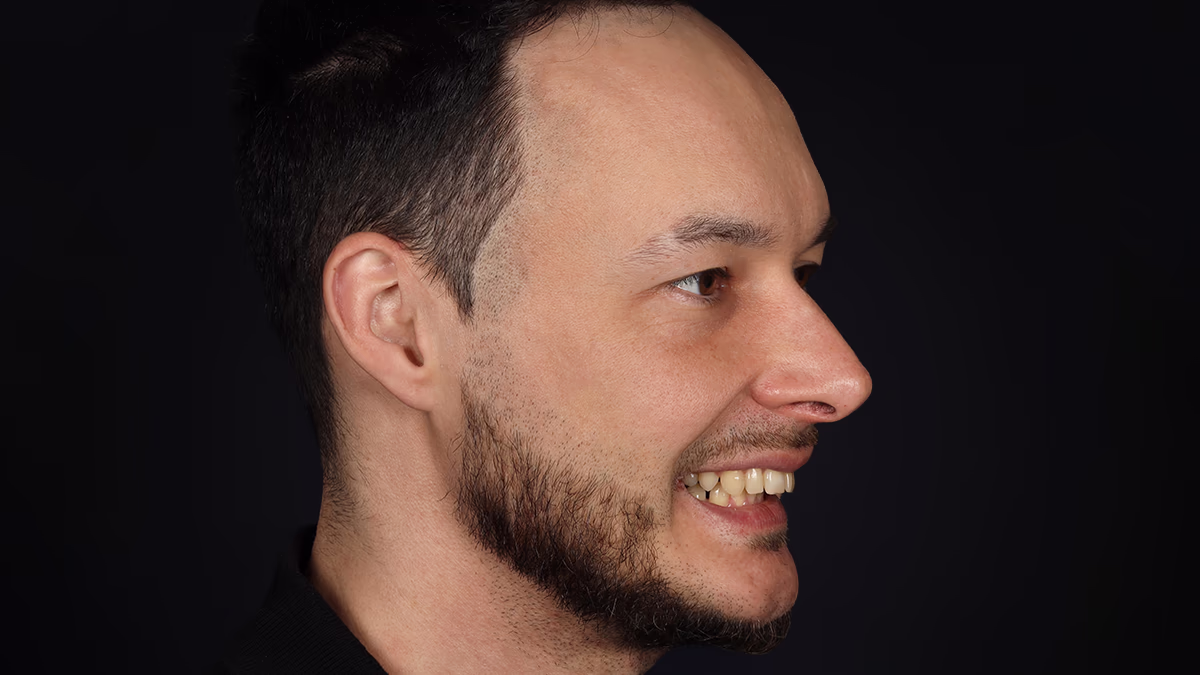 Бічний портрет усміхненого чоловіка з темним коротким волоссям і бородою на чорному фоні.