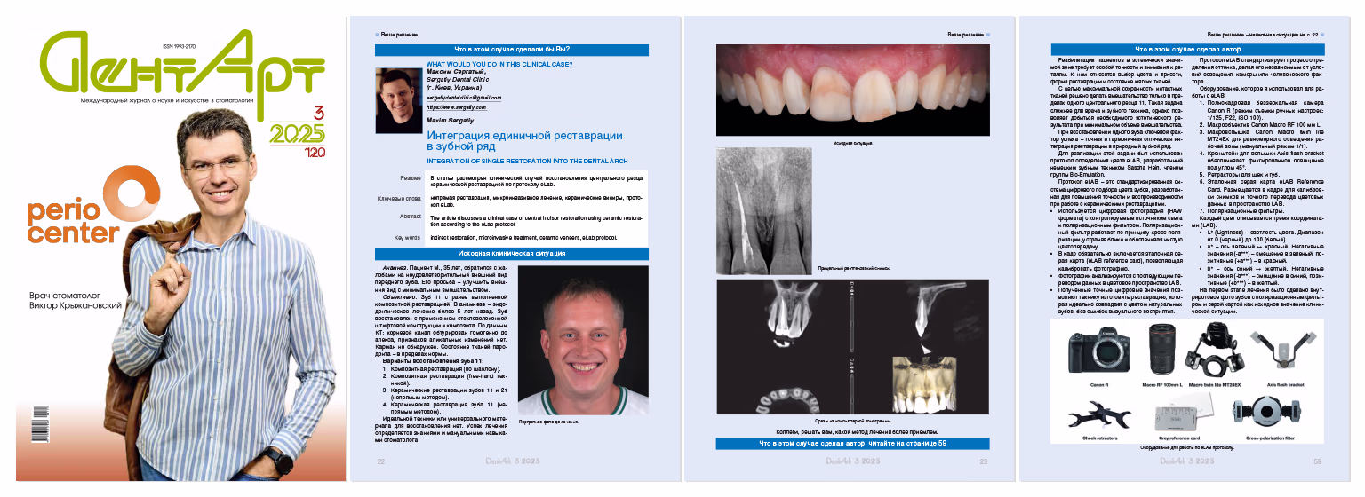 Обкладинка стоматологічного журналу з чоловіком, що посміхається і тримає коричневу сумку, а також сторінки з клінічним випадком реставрації зуба з текстом, фото пацієнта, рентгенівськими знімками зубів і зображеннями стоматологічного обладнання.