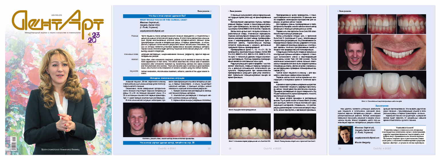 Обкладинка журналу «ДентАрт» з портретом лікаря-стоматолога Ангеліки Яцмєц, а також сторінки з клінічним випадком, фотографіями зубів і лікарем Максимом Сергатієм, опис клінічного лікування в стоматології.