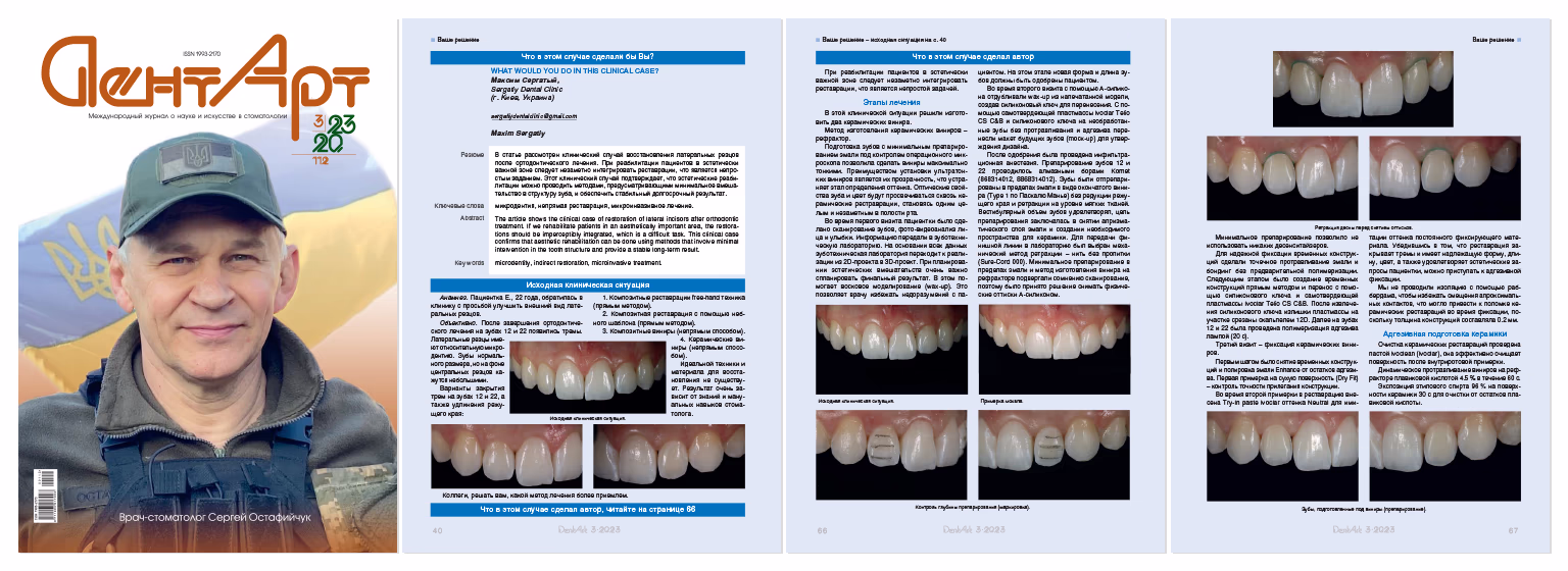 Обкладинка журналу «DentArt» з фото чоловіка у кепці, а також сторінки зі стоматологічною клінічною статтею про реставрацію зубів із фотографіями до і після лікування.