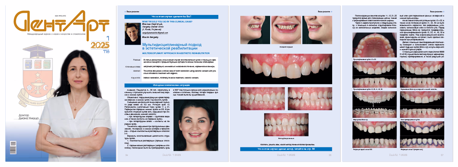 Обкладинка журналу із зображенням жінки в білому халаті та сторінки зі статтею про мультидисциплінарний підхід до естетичної реабілітації зубів із клінічними фотографіями до і після лікування.