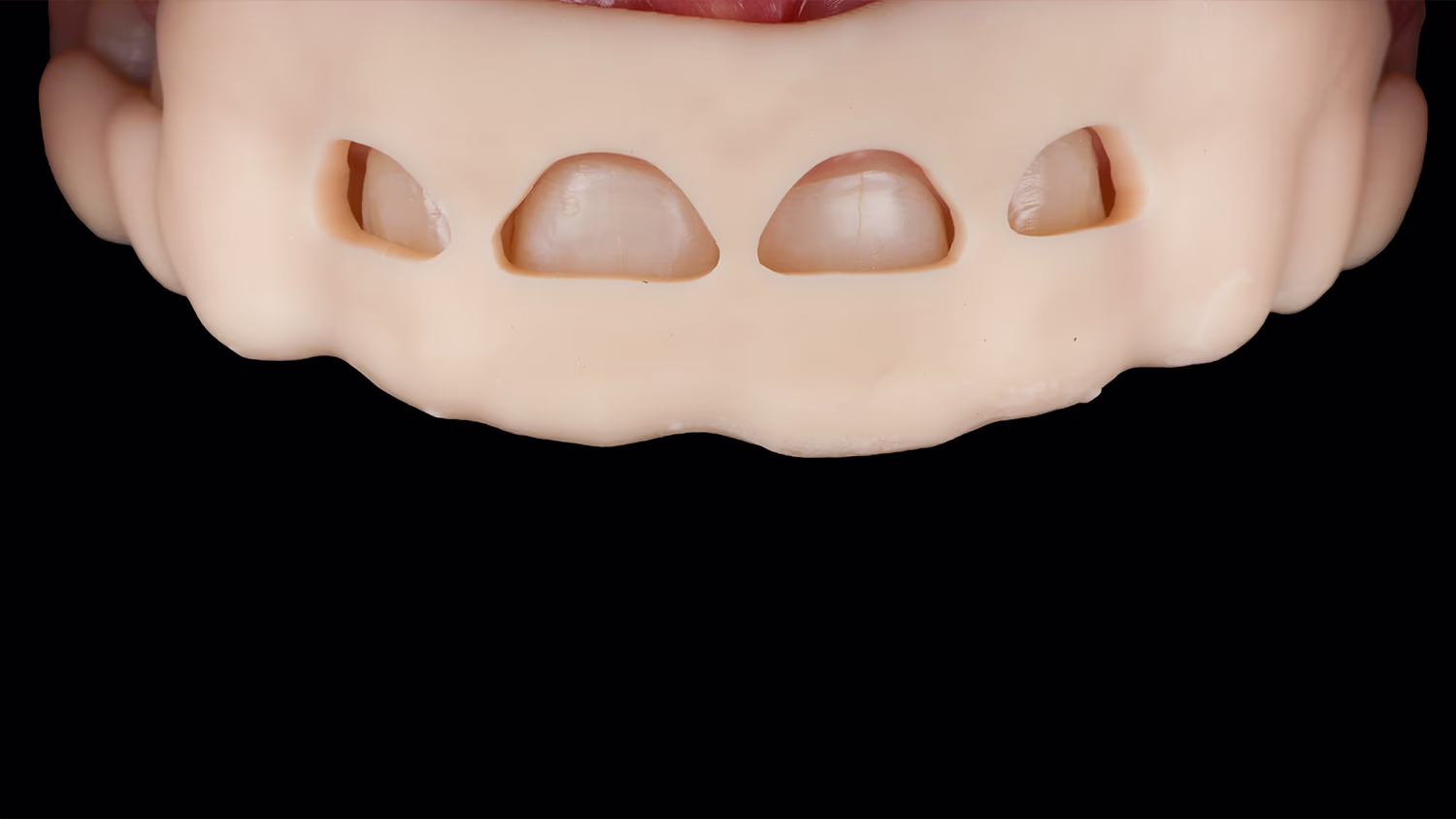 Корекція ясен за допомогою шаблону