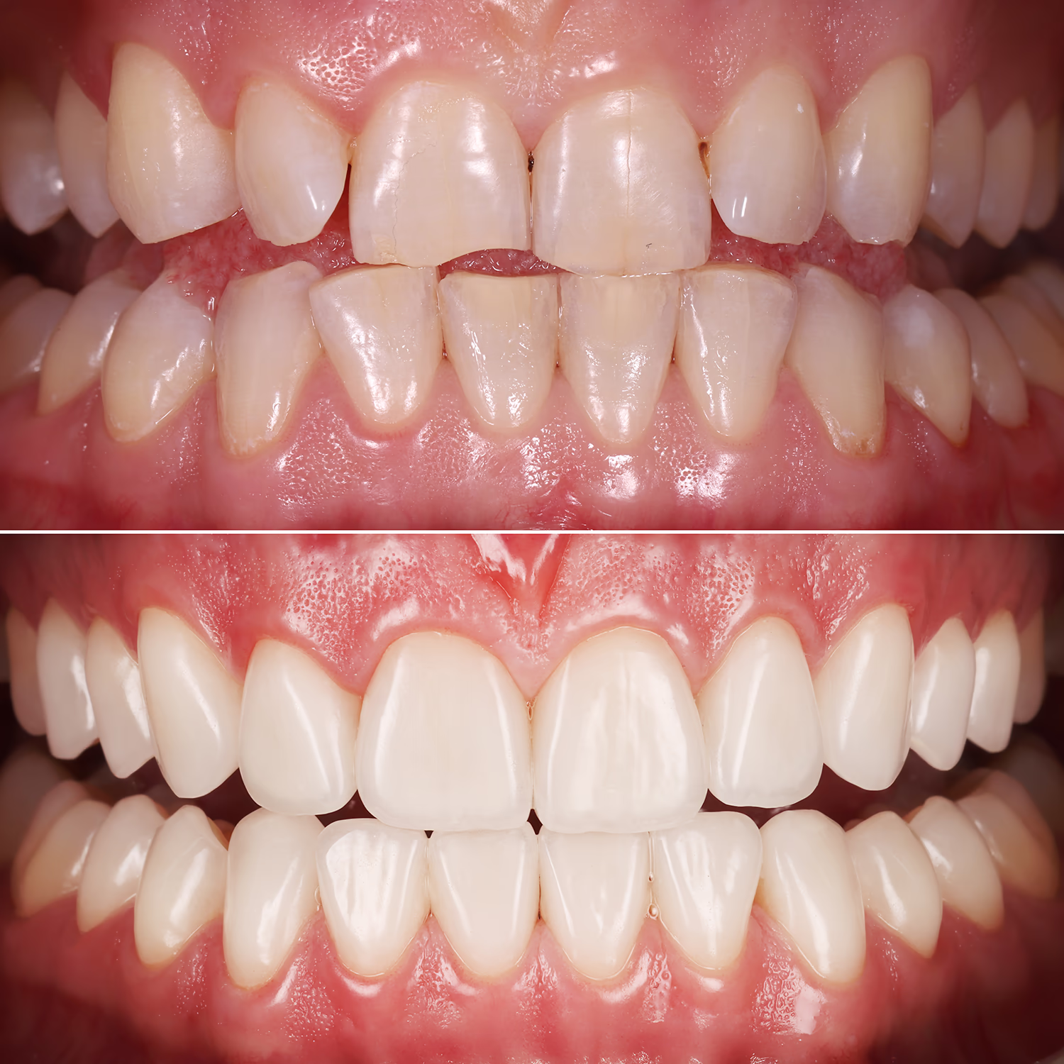 Фото порівняння до та після лікування