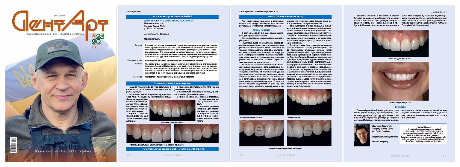 Обкладинка журналу «DentArt» з фото чоловіка у кепці, а також сторінки зі стоматологічною клінічною статтею про реставрацію зубів із фотографіями до і після лікування.