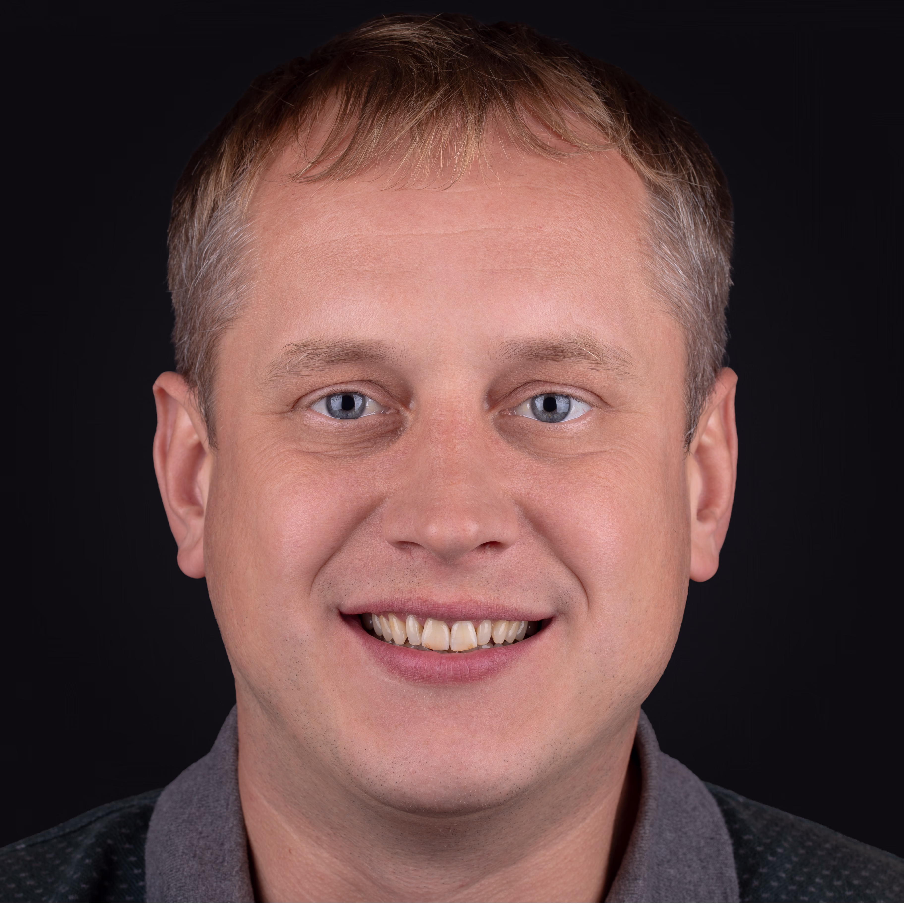 Чоловік зі світлим волоссям з посмішкою демонструє результат лікування.