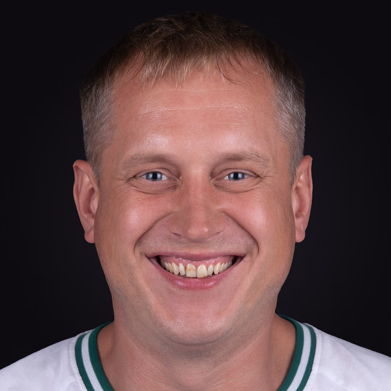 Портретне фото пацієнта до лікування