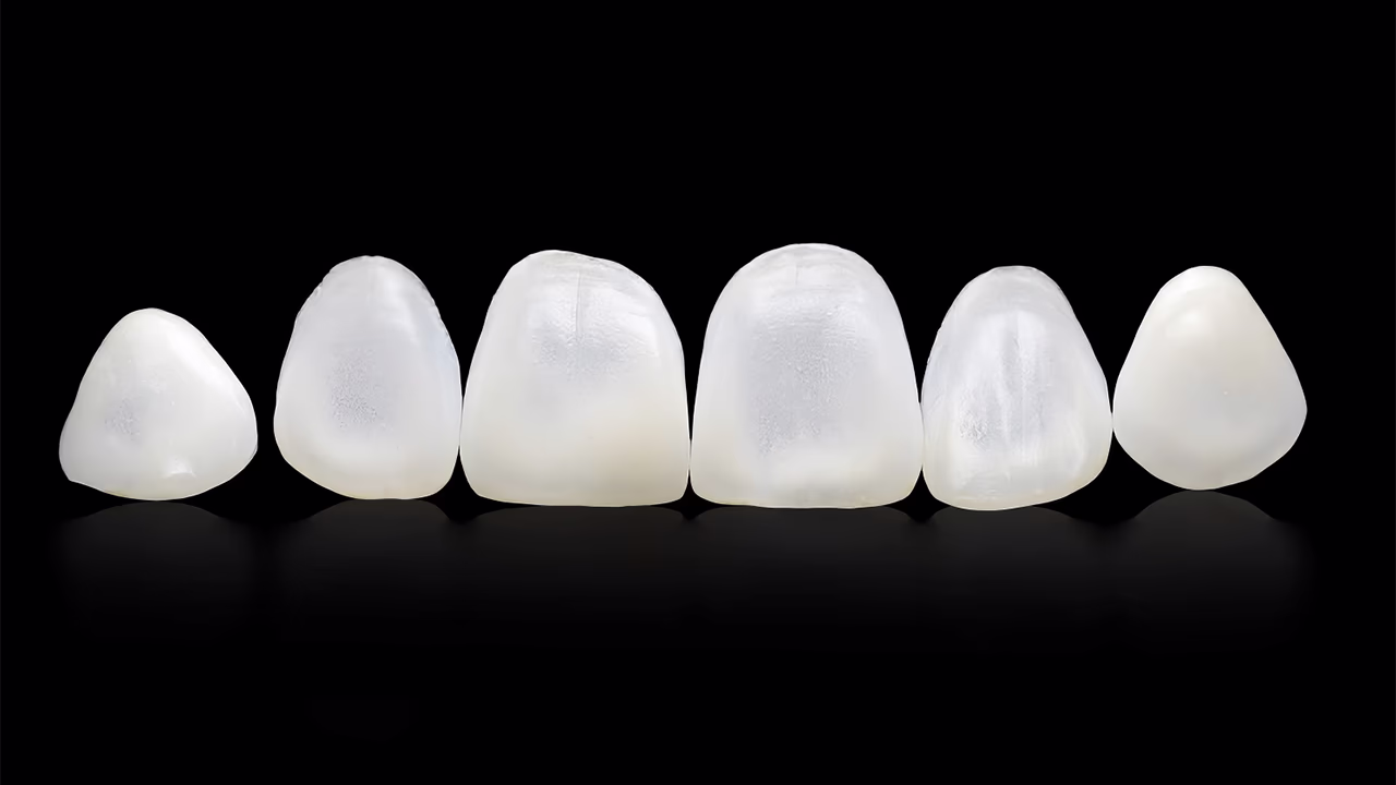 Шість тонких керамічних вінірів на чорному фоні, розташовані в один ряд.