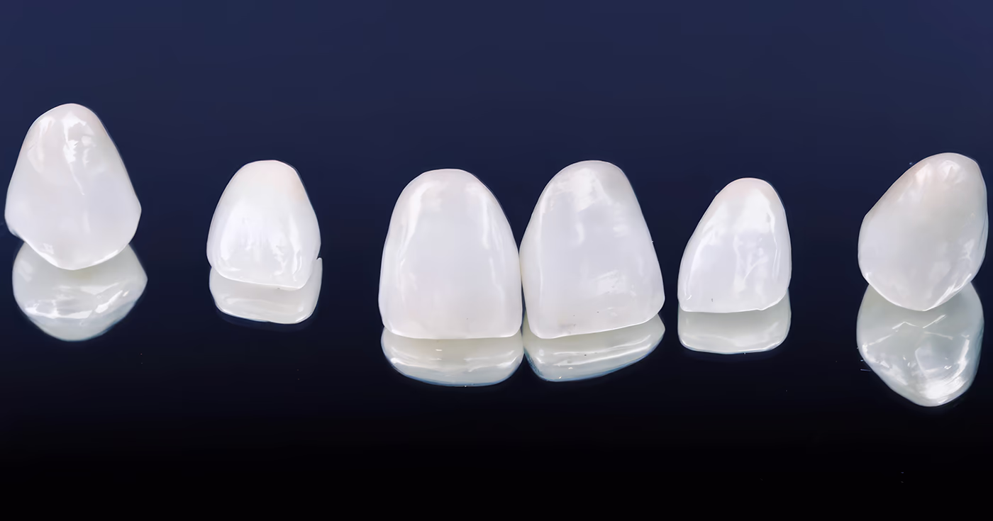 Керамічні вініри різної форми, розміщені на темному фоні