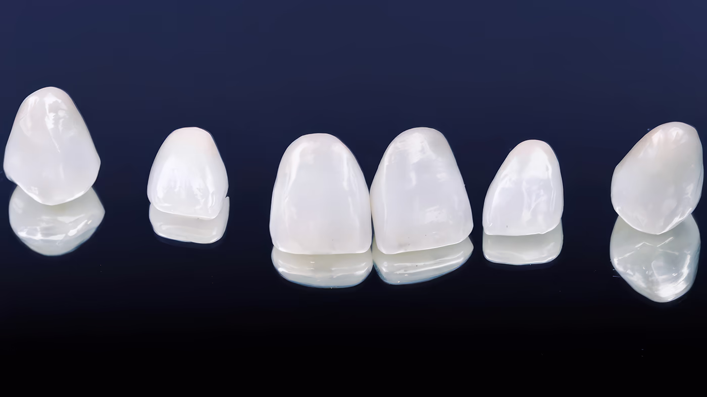 Ceramic veneers of various shapes placed on a dark background