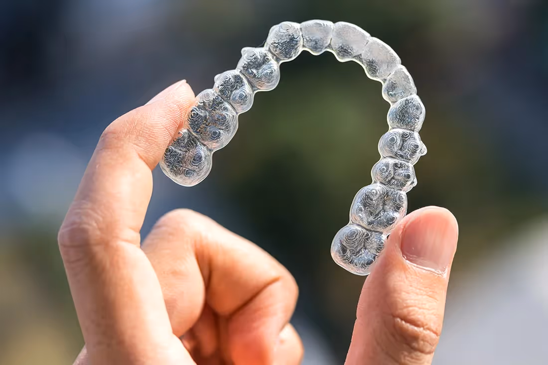 service invisalign