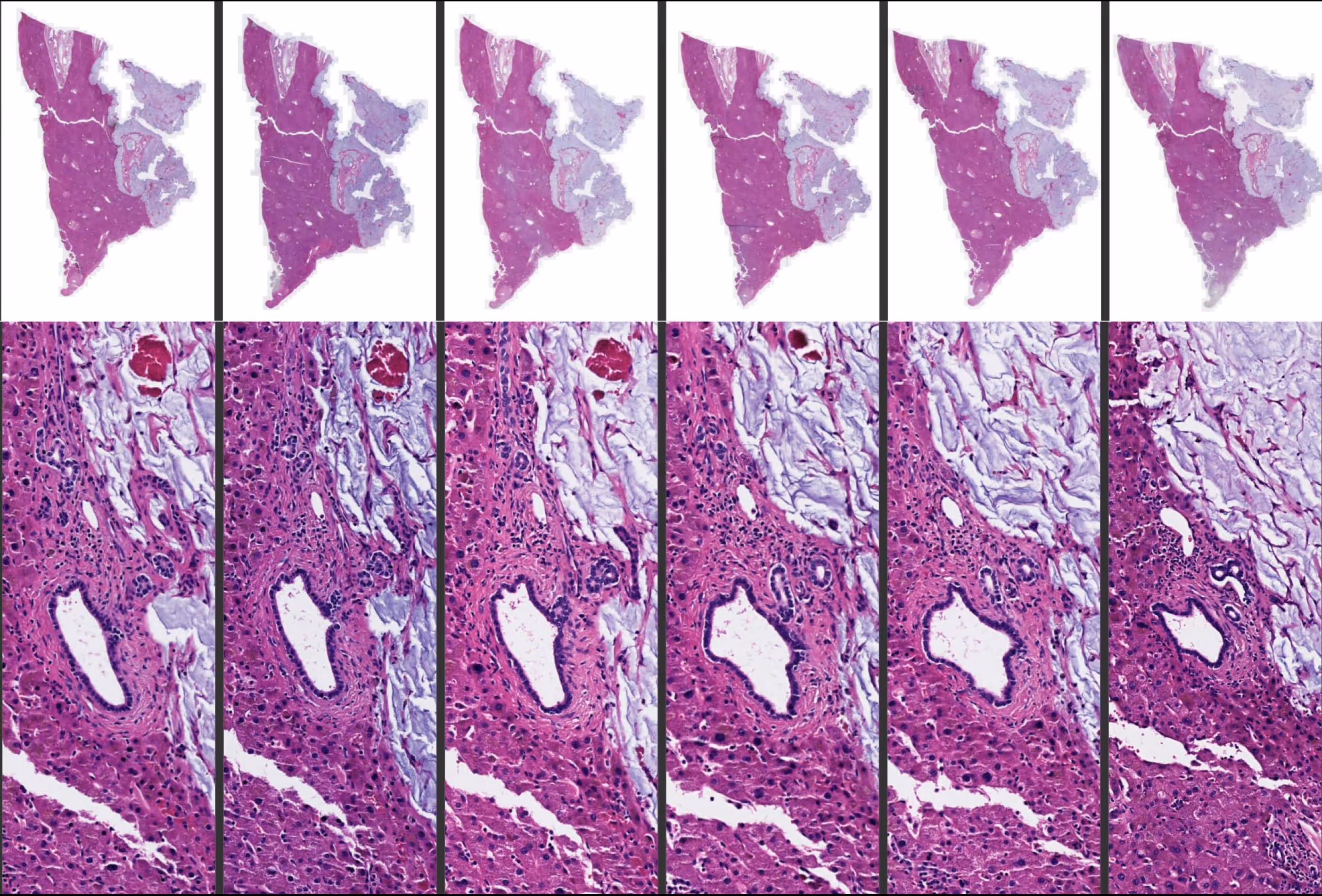 Six histology slides showing progressive changes in tissue structure stained with hematoxylin and eosin, with increasing magnification from top to bottom.