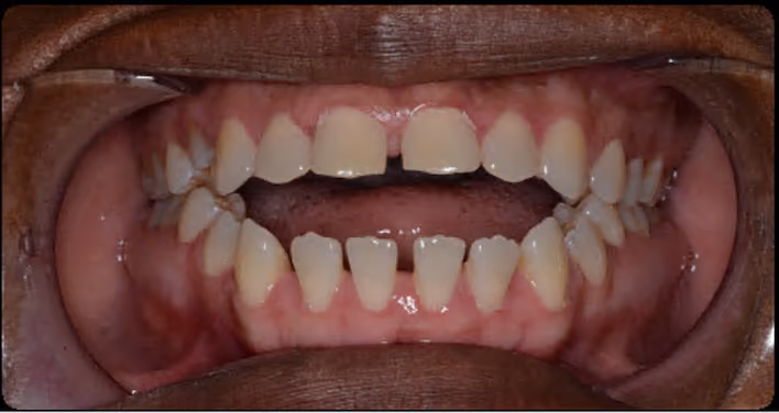 Before Image
