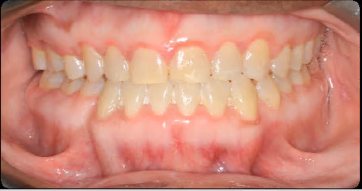 After Image