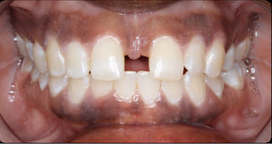 Before Image