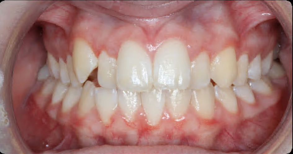 Before Image