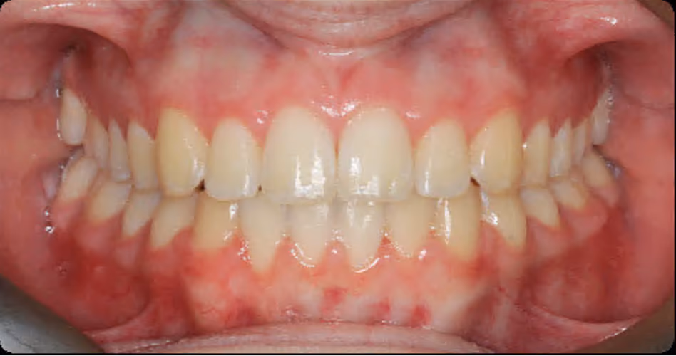 After Image