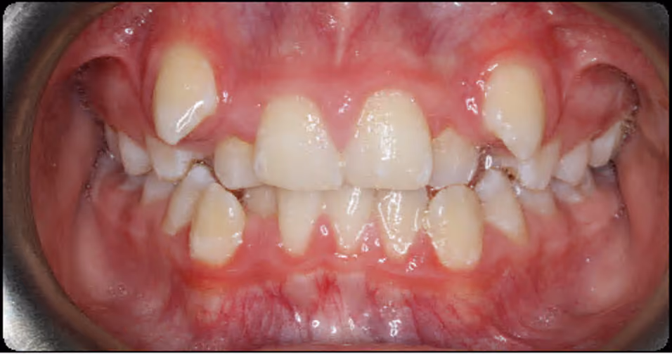 Before Image