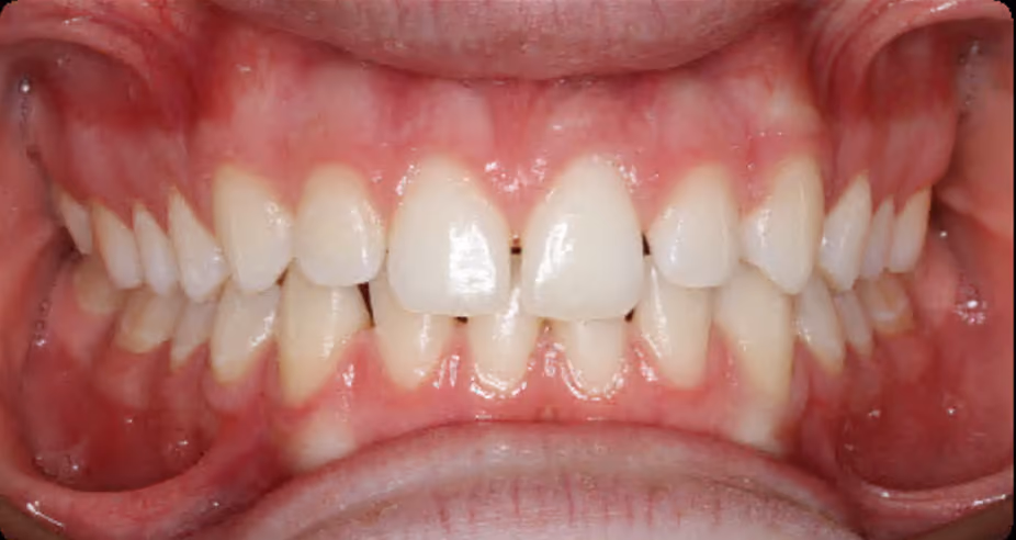 Before Image