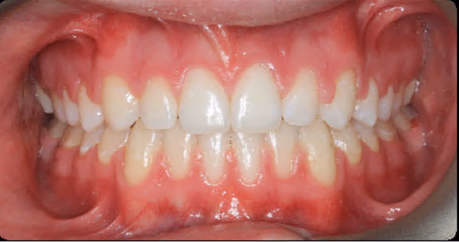After Image