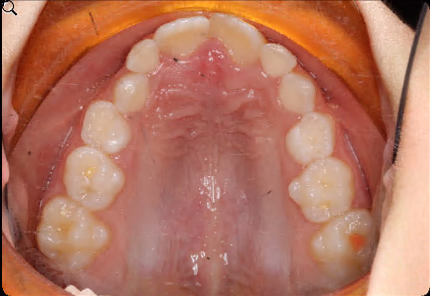 Before Image